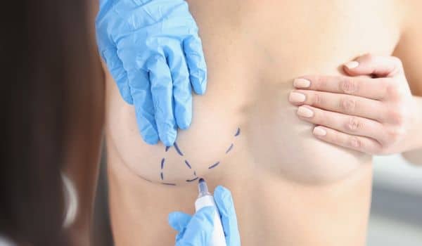 Large Breasts Can Cause Back Pain and Breast Pain - Breast Reduction  Surgery - MTM